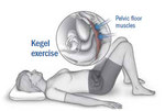 Kegel en Envigado